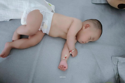 万宁六个月宝宝眼睛散光